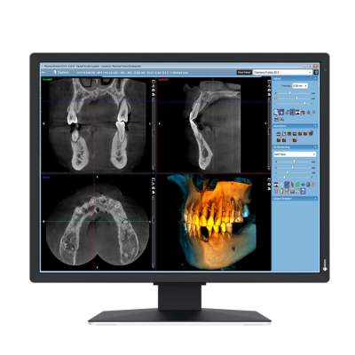 MX 217-SB RadiForce